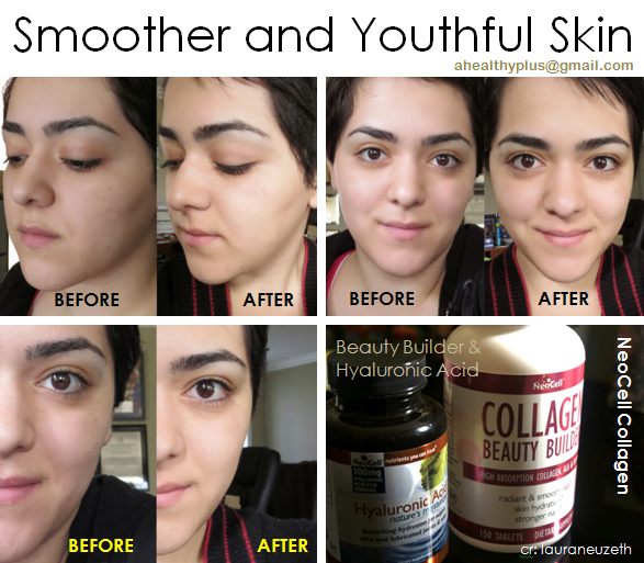 นีโอเซลคอลลาเจน (Neocell Collagen Beauty Builder)