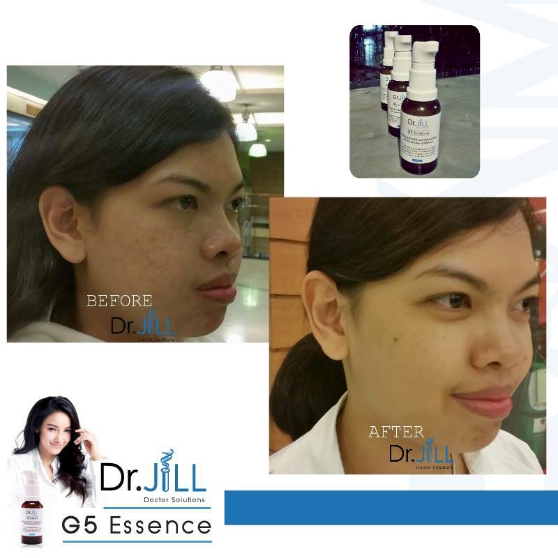 เซรั่ม Dr.Jill G5 Essence เซรั่มครีม แพท ณปภา โปรส่งฟรี EMS