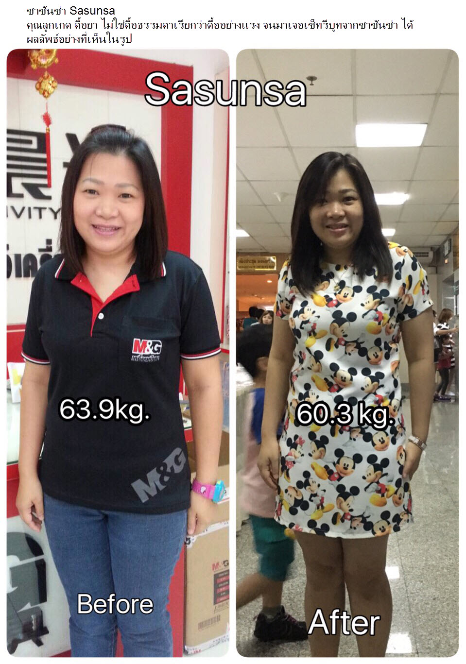 SASUNSA ซาซันซ่า ลดน้ำหนัก เซ็ตเดียวเอาอยู่