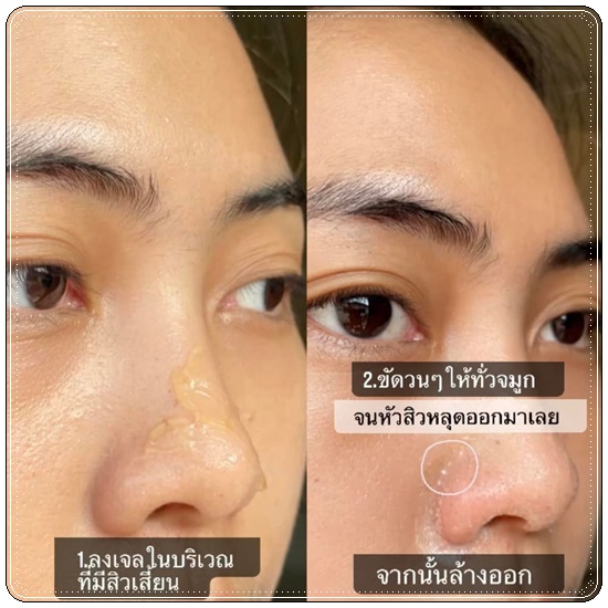 เจลมะม่วงสครับผิว RtopR mango Exfoliating Cream เจลขัดสิวเสี้ยน