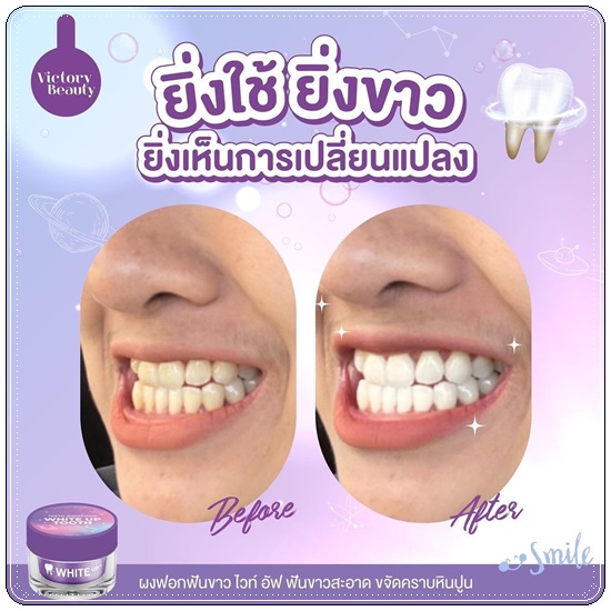 ผงฟอกฟันขาว ไวท์ อัพ Teeth Whitening White Up Tooth