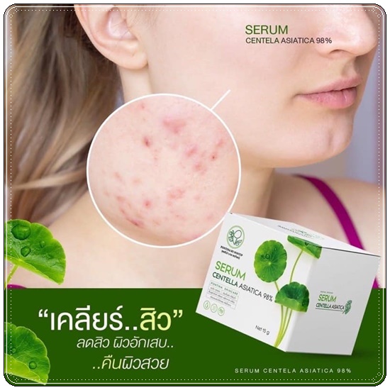เซรั่มใบบัวบก ผสมว่านหางจระเข้ Serum Centella Asiatica Pontina