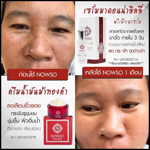 เซรั่มนาวโซ Nowso Madonna Lily Serum