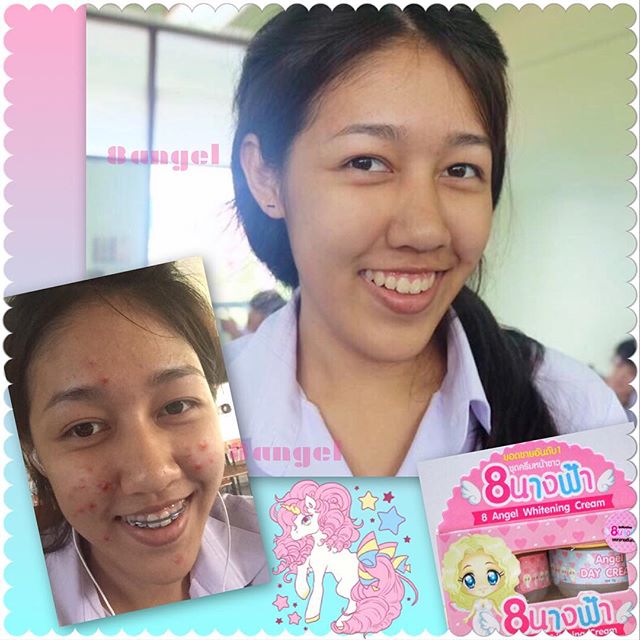 ชุดครีมหน้าใส 8นางฟ้า (8 Angel Whitening Cream)