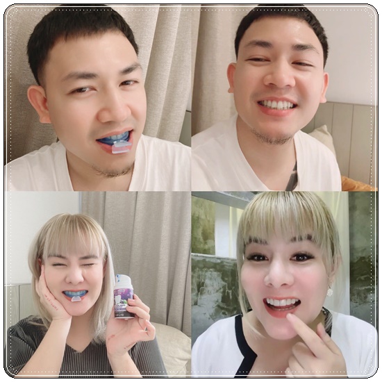 ยาสีฟัน เดนทัล สวิตซ์ Dental Switz เจลฟอกฟันขาว (1แถม1 ส่งฟรี)