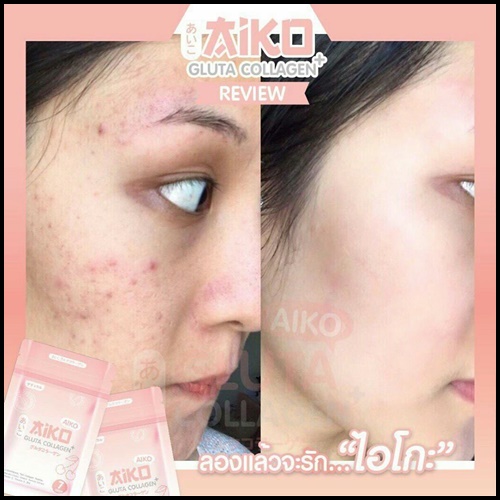 ไอโกะ กลูต้า คอลลาเจน Aiko Gluta Collagen