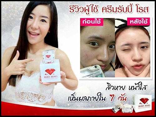 รับบี้ โรส ครีม Ruby Roses Cream ครีมรากหญ้า