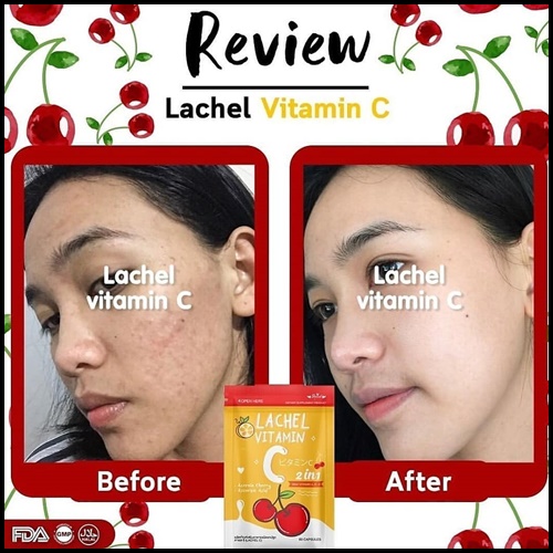 LACHEL VITAMIN C ลาเชล ซี