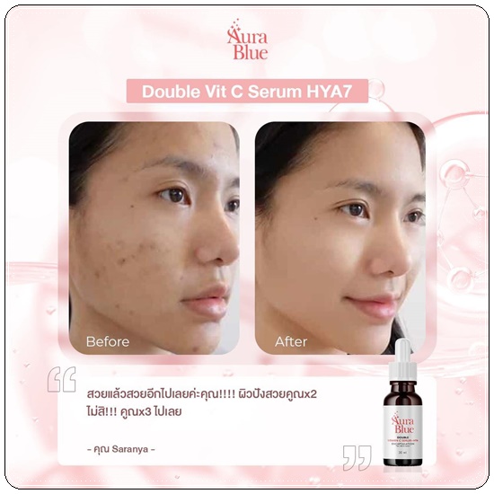 เซรั่มออร่าบลู Aura Blue Double Vitamin C Serum+HYA (ของแท้)