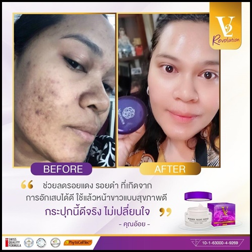 ครีมวีทู V2 REVOLUTION WONDER NIGHT REPAIR สูตรใหม่