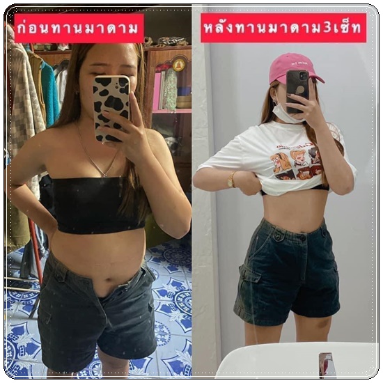 ยูเน่เอส Une'S ดับเบิ้ลเอส พลัส Madam Double S Plus (แพ็คเกจใหม่) 1แถม1