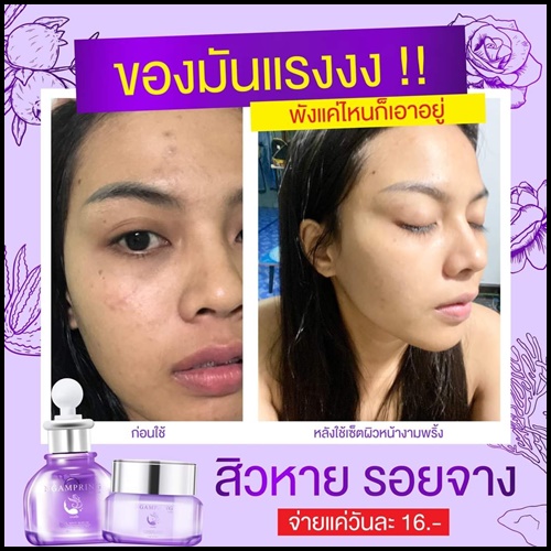 เซ็ตงามพริ้ง Ngampring ครีมงามพริ้ง แถมฟรี เซรั่มงามพริ้ง (1แถม1)