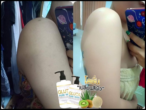 โลชั่นกลูต้าเพียวไวท์ Gluta Pure White