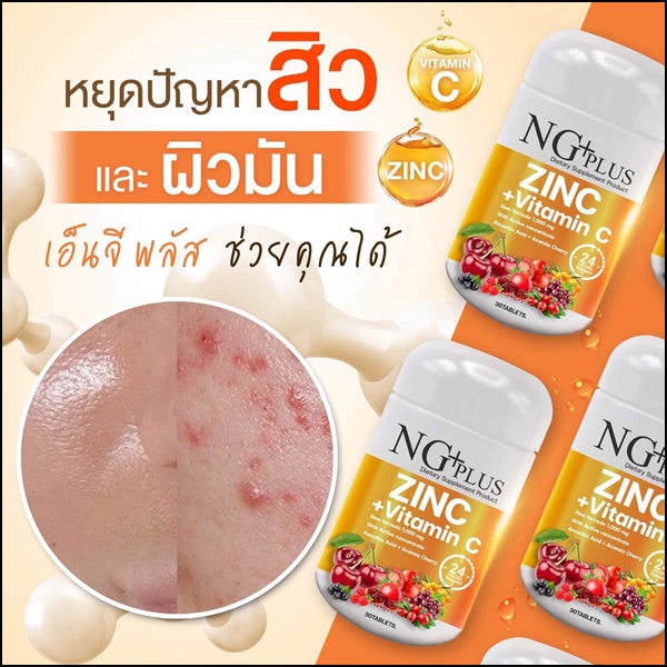 NG Plus Zinc Vitamin C เอ็นจี พลัส วิตามินซี+ซิงค์ (ส่งฟรี)