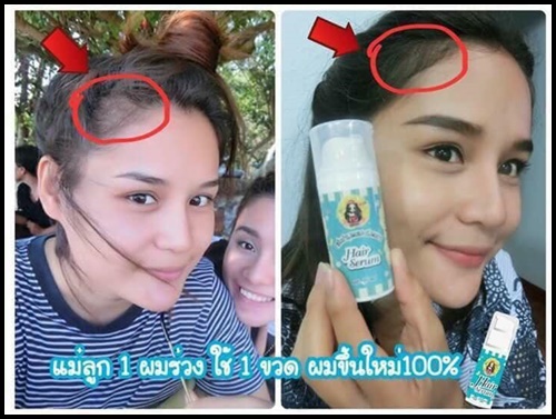 แฟรี่ปาย แฮร์เซรั่ม Hair Serum เร่งผมยาว
