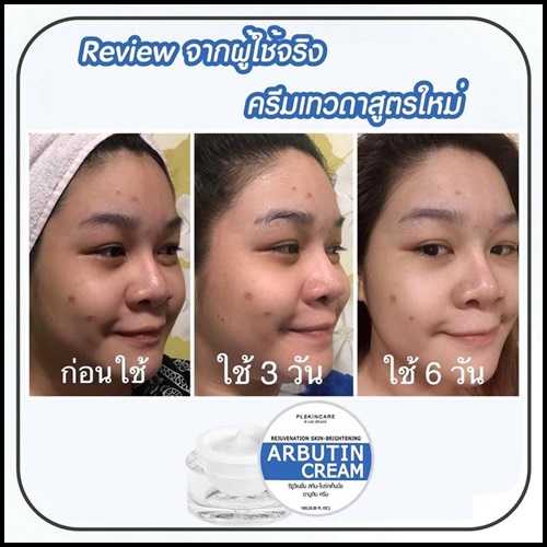 ครีมอาบูติน ครีมเทวดา สูตรใหม่ REJUVENATION SKIN-BRIGHTENING ARBUTIN CREAM
