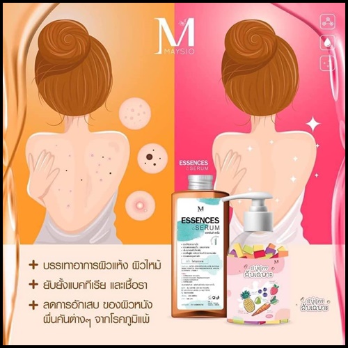สบู่สูตรลับเฉพาะ Maysio แถมฟรี Essences Serum (แพ็คเกจใหม่)