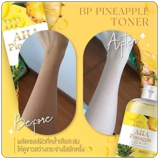 โทนเนอร์สับปะรด BP AHA Pineapple All in One Toner โทนเนอร์เช็ดขาว (1แถม1)