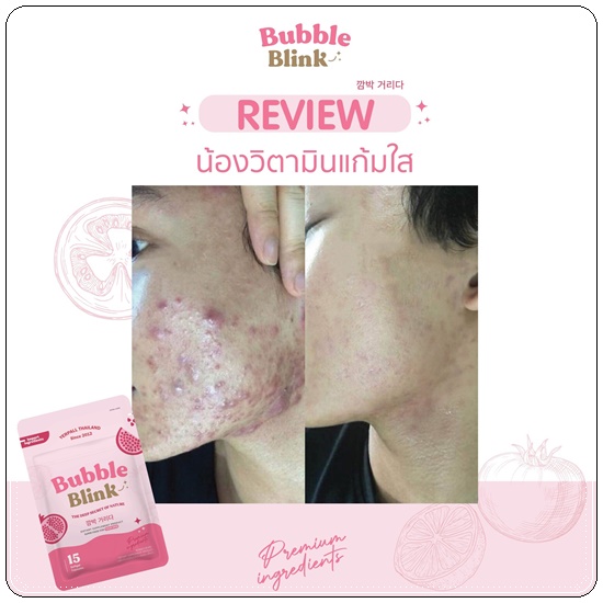 วิตามินแก้มใส Bubble Blink Yerpall (ของแท้)