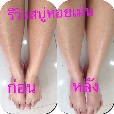 สบู่หอยเม่น (Sea Urchin Soap By Night Merry)