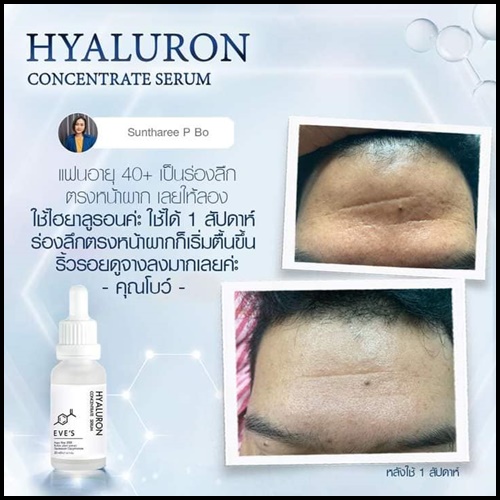 เซรั่มไฮยาอีฟส์ EVE'S Hyaluron Concentrate Serum