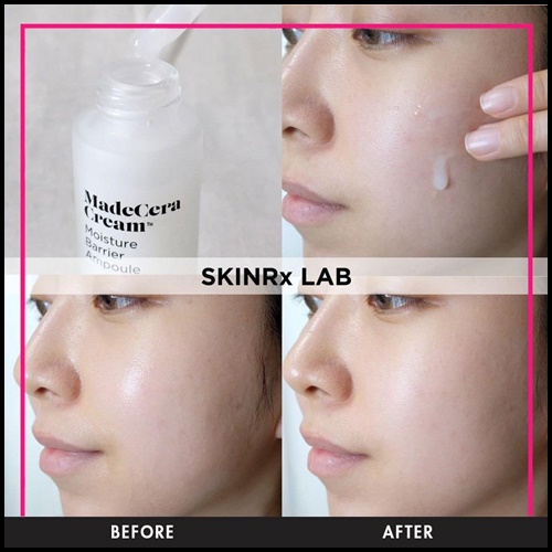 เซรั่ม SKINRx LAB MadeCera Cream Moisture Barrier Ampoule / Fresh Clearing Ampoule