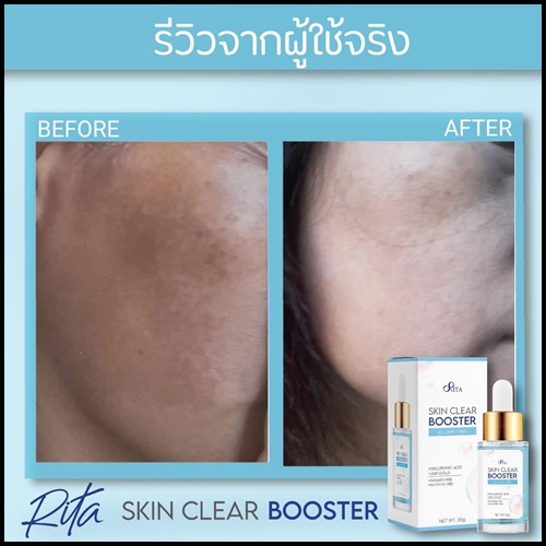 เซรั่มริต้า Rita Skin Clear Booster Serum เคลีย์ สกิน บูสเตอร์