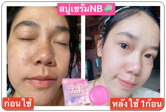 สบู่เซรั่ม NB Serum Soap Skin Whitening สบู่ครูเบียร์