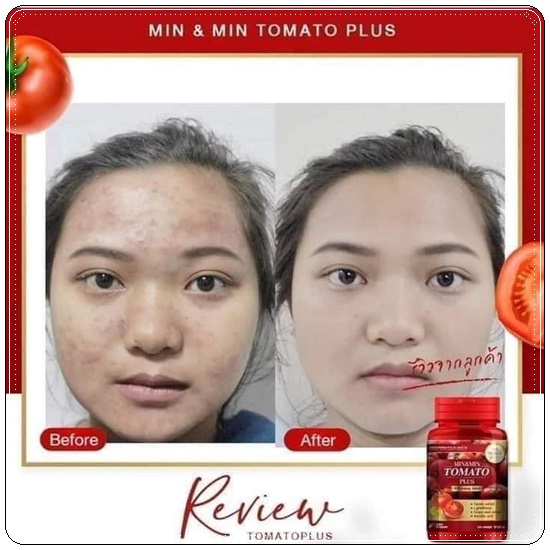 Min&Min Tomato Plus มินมิน โทเมโทะ พลัส