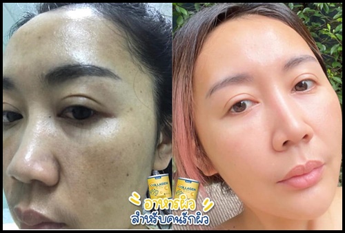 คอลลาเจนเพียว Nakata Collagen นาคาตะคอลลาเจน ( 1แถม1 )