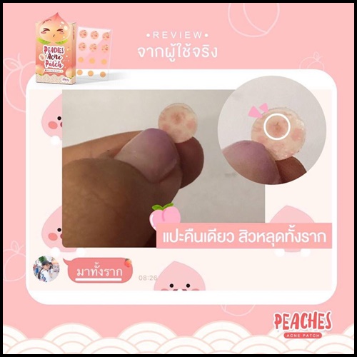 เเผ่นเเปะสิว พีชเชส PEACHES