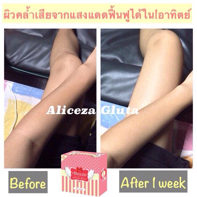 Aliceza Gluta By Nanny (สูตรใหม่)