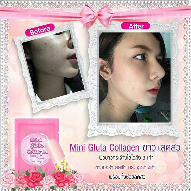มินิกลูต้าคอลลาเจน Mini Gluta Collagen โปรสุดคุ้ม