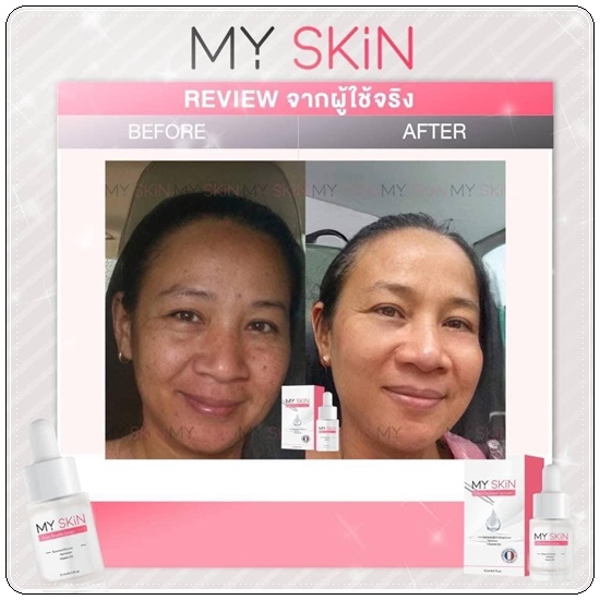 เซรั่ม MY SKin Golw Booster Serum เซรั่มหน้าเงา
