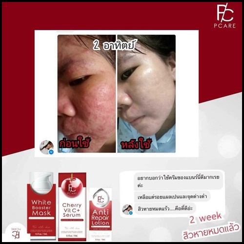 โลชั่นฆ่าเชื้อสิว Pcare Anti - Repair lotion