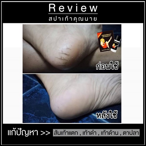 สปาเท้าคุณนาย สูตรใหม่