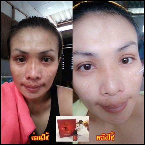 เซรั่มน้ำมันม้าสลายฝ้า Horse Oil Serum By BCS