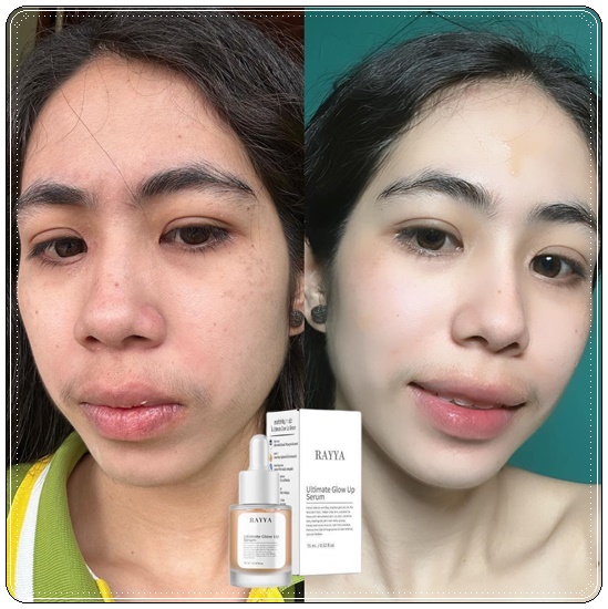 เซรั่มเรยา RAYYA Ultimate Glow Up Serum เซรั่มรีจูรัน (1แถม1)