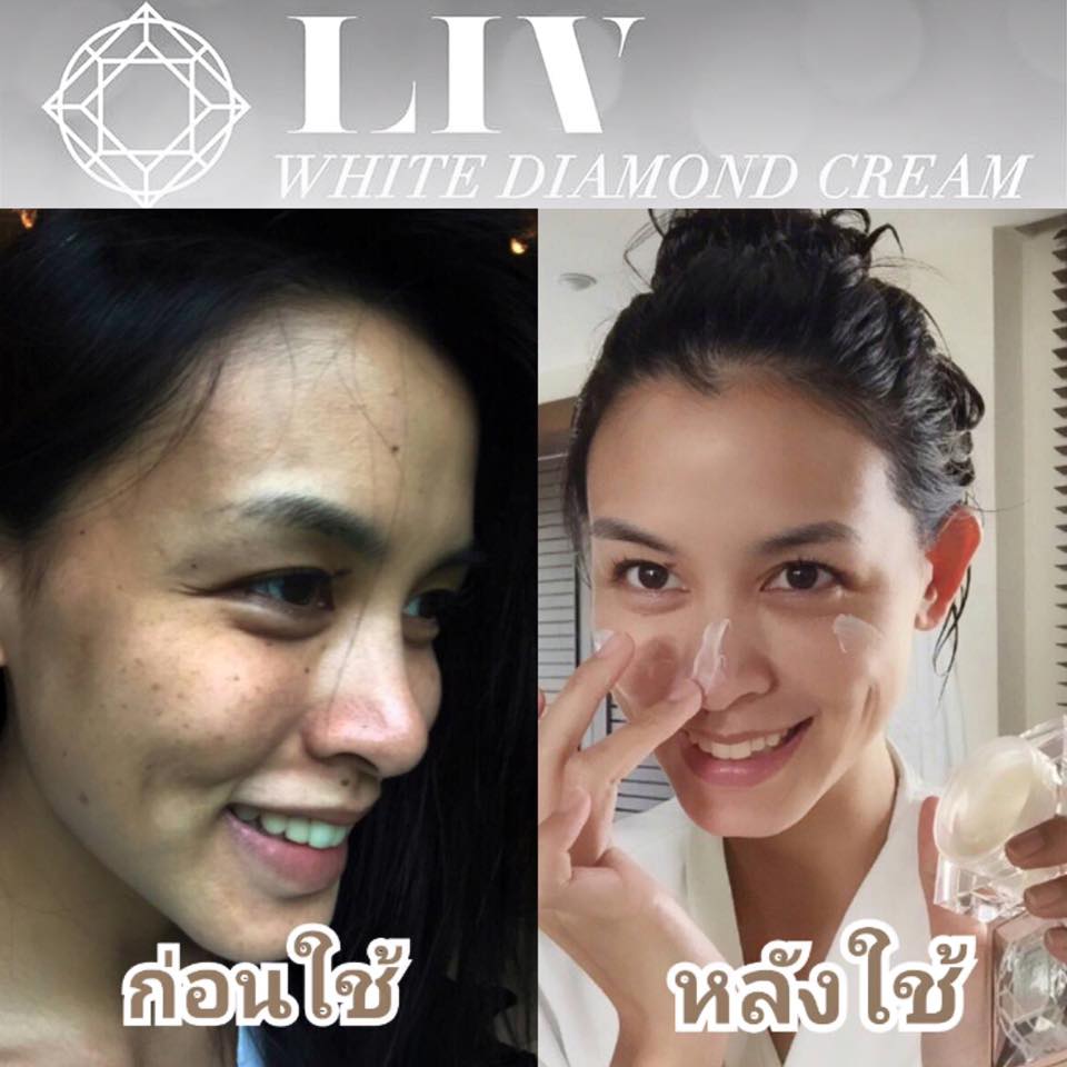 ครีมลิฟ ไวท์ ไดมอนด์ (Liv White Diamond) ครีมวิกกี้ โปรโมชั่น ส่งฟรี ทั่วไทย