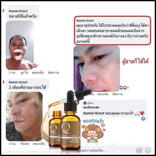 เซรั่ม Q Double Serum เซรั่มสลายฝ้า หน้าเด็ก (ของแท้ ส่งฟรี)