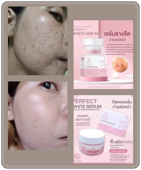 เซรั่มรางจืด พรทิน่า Perfect White Serum