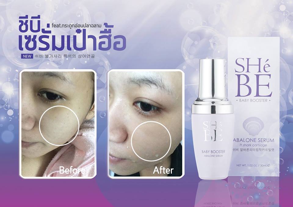 SHeBE BABY BOOSTER ABALONE SERUM(เซรั่มเป๋าฮื้อ)