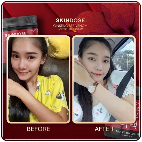 โสมพิษผึ้งจักรพรรดิ Skindose Ginseng Bee Venom โลชั่นผิวขาว สูตรกลางคืน (ส่งฟรี)