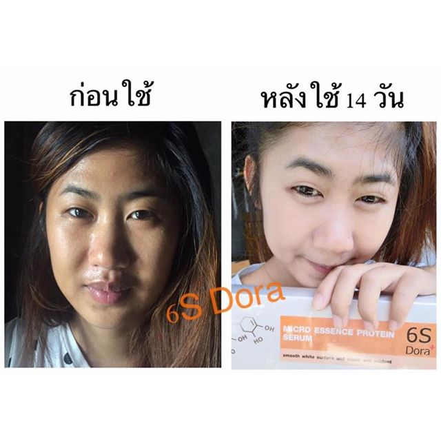 เซรั่มหน้าใสเด้ง 6S Dora+ (Micro Essence Protein Surum) ส่งฟรี EMS