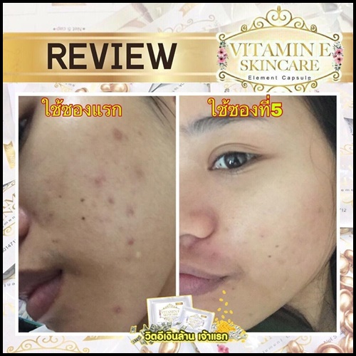 วิตามินอี บำรุงผิวหน้า By Nifty (Vitamin E Skincare)