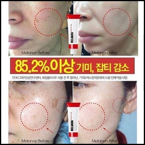 MEDI-PEEL melanon X cream หลอดสีแดง ลดฝ้า กระ จุดด่างดำ