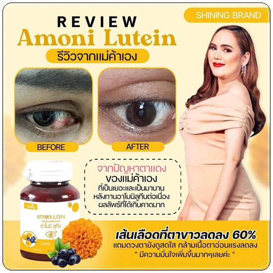 อาโมนิลูทีน Amoni Lutein วิตามินบำรุงสายตา