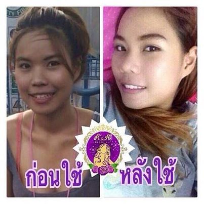 ใหม่ เซตครีมองุ่นหน้าใส K&K Beautiful (10กรัม)