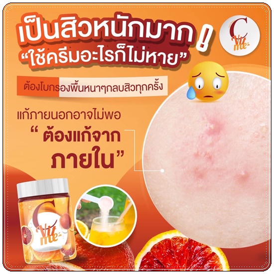 C Vit Me ซีวิทมี น้ำชงวิตามินซีเข้มข้น (ของแท้)