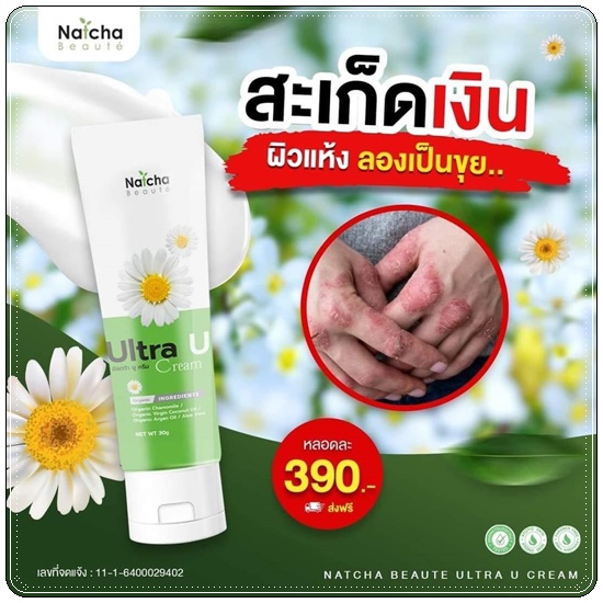 อัลตร้า ยู ครีม Ultra U Cream Natcha ลดอาการคัน กลากเกลื้อน
